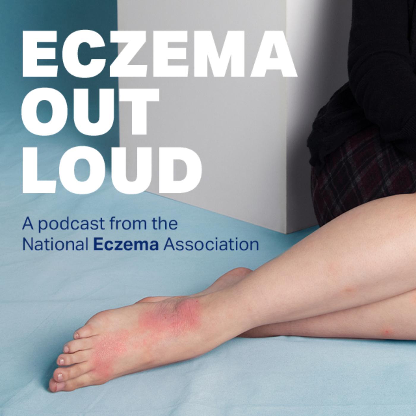 Eczema Out Loud (podcast) - National Eczema Association | Listen Notes