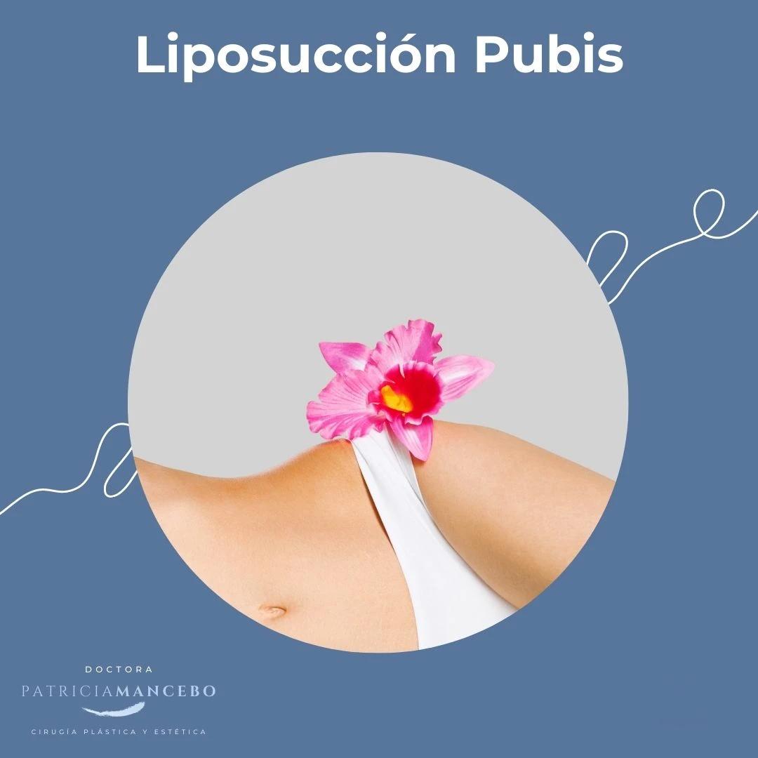 Liposucción de Pubis - El Rincón de la Cirugía Plástica (podcast) | Listen  Notes