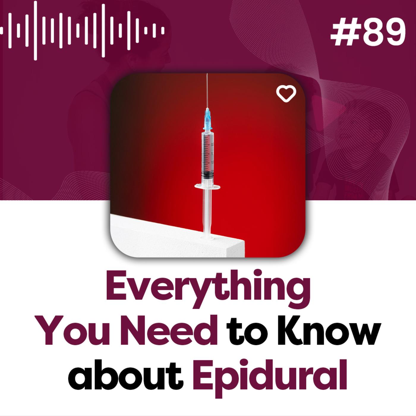 89 Everything You Need To Know About Epidurals The Mamastefit